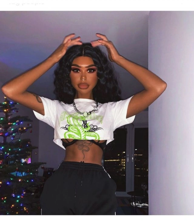 Ганна Тіттензор - 23-річна ірландка, яка завжди мріяла стати темношкірою (15 фото) – фото 10