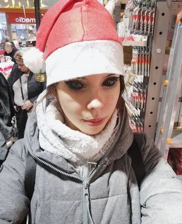 Дівчина хотіла виглядати як свій кумир, але тепер вона може осліпнути (5 фото) – фото 3