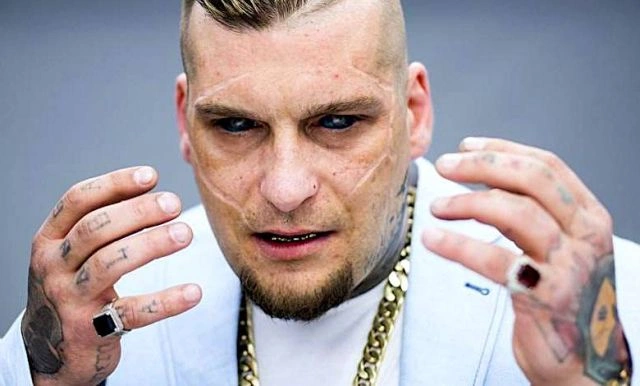 Дівчина хотіла виглядати як свій кумир, але тепер вона може осліпнути (5 фото) – фото 5