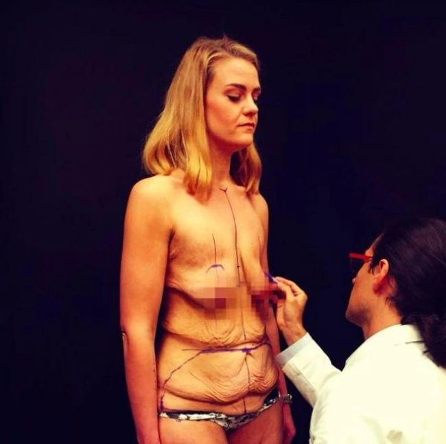 Повна дівчина скинула зайву вагу і отримала фігуру своєї мрії (9 фото) – фото 3