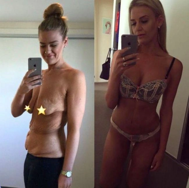 Повна дівчина скинула зайву вагу і отримала фігуру своєї мрії (9 фото) – фото 5