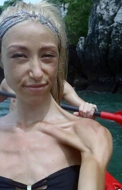 Дівчина перемогла анорексію за допомогою бодібілдингу (11 фото) – фото 2