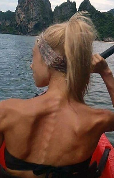 Дівчина перемогла анорексію за допомогою бодібілдингу (11 фото) – фото 3