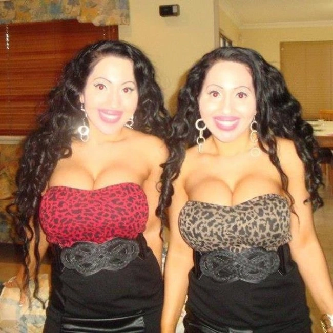 Австралійські близнята витратили 250 000 доларів, щоб стати найбільш схожими людьми один на одного (10 фото) – фото 5