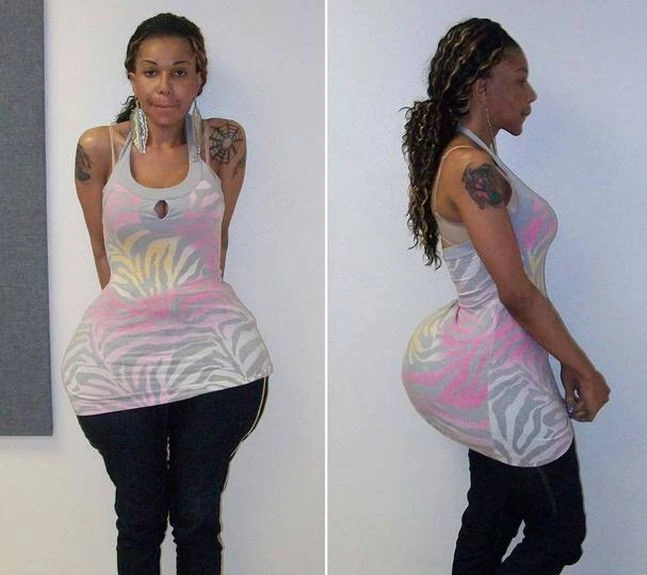 Дівчата з силіконовими сідницями (16 фото)