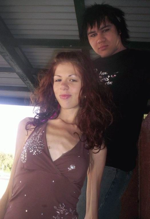 Хвороба музики - анорексія (44 фото) – фото 2