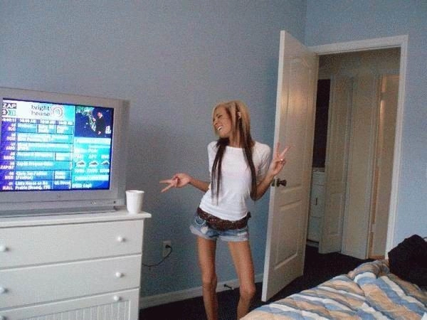 Хвороба музики - анорексія (44 фото) – фото 6