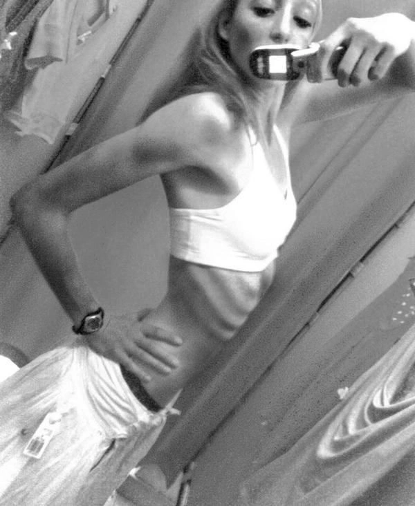 Хвороба музики - анорексія (44 фото) – фото 10