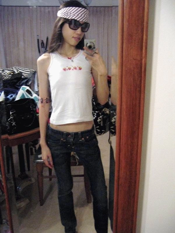 Хвороба музики - анорексія (44 фото) – фото 13