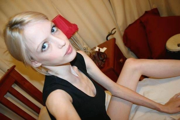 Хвороба музики - анорексія (44 фото) – фото 14