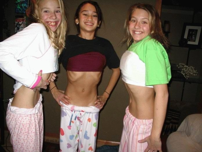 Хвороба музики - анорексія (44 фото) – фото 18