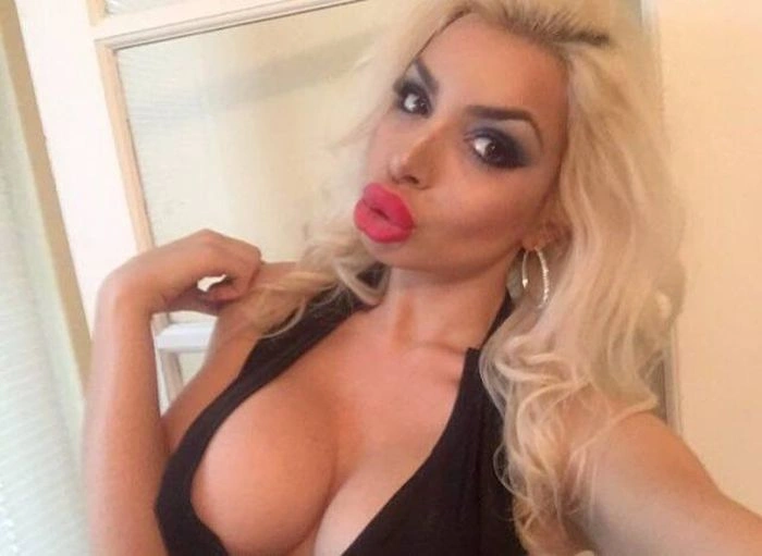 Дівчата, які переборщили з силіконом (45 фото) – фото 7