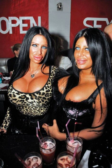 Дівчата, які переборщили з силіконом (45 фото) – фото 8