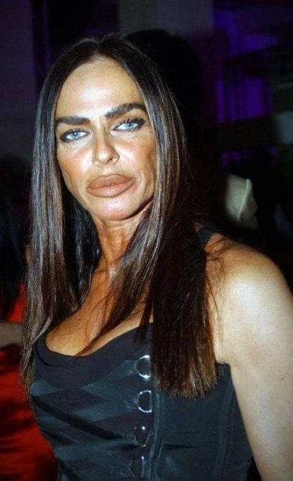 Дівчата, які переборщили з силіконом (45 фото) – фото 10