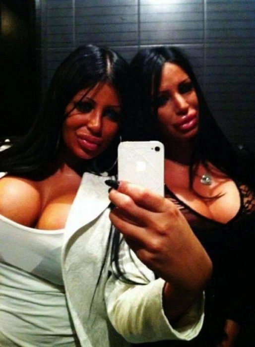 Дівчата, які переборщили з силіконом (45 фото) – фото 18