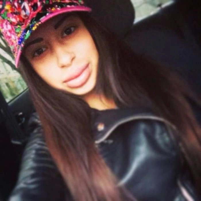 Дівчата, які переборщили з силіконом (45 фото) – фото 23