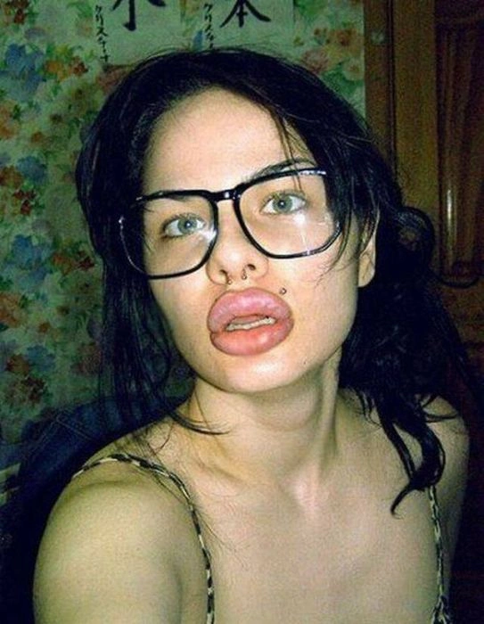 Дівчата, які переборщили з силіконом (45 фото) – фото 33