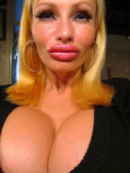 Дівчата, які переборщили з силіконом (45 фото) – фото 40