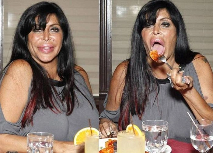 Дівчата, які переборщили з силіконом (45 фото) – фото 42