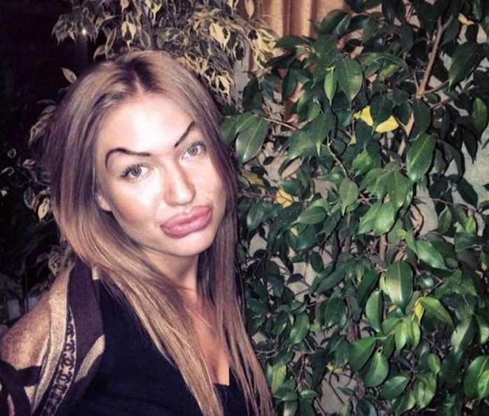 Дівчата, які переборщили з силіконом (45 фото) – фото 45