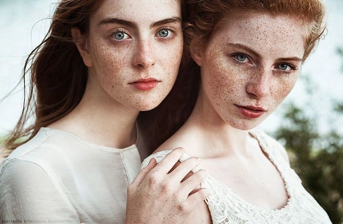 Чарівні дівчата з веснянками (30 фото) – фото 27