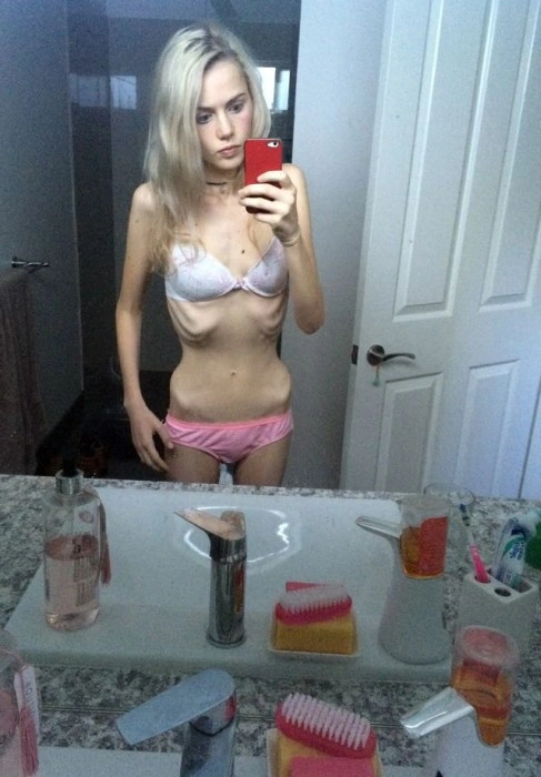 Незвичайні метаморфози юної австралійки (11 фото) – фото 3