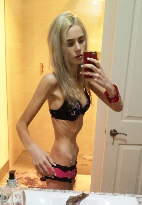 Незвичайні метаморфози юної австралійки (11 фото) – фото 6