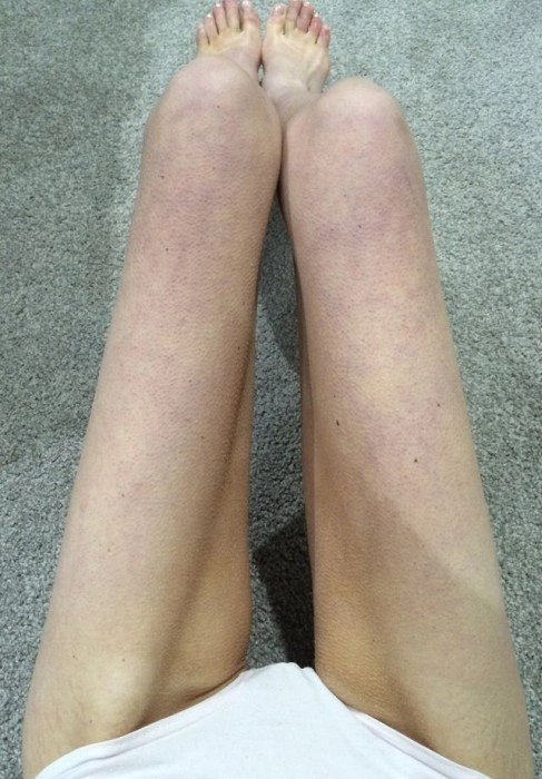 Незвичайні метаморфози юної австралійки (11 фото) – фото 8