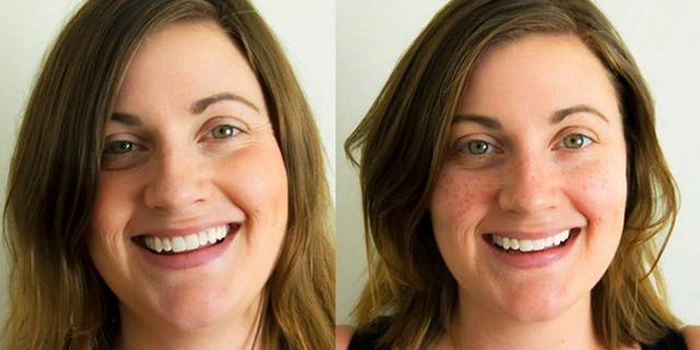 Новий тренд "штучні веснянки" (15 фото) – фото 7