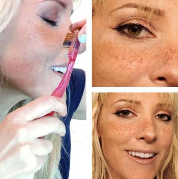 Новий тренд "штучні веснянки" (15 фото) – фото 12