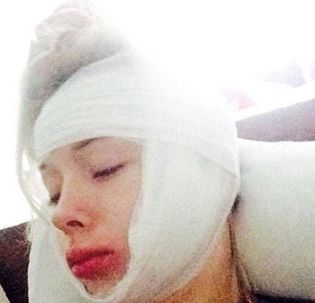 На Валерію Лук'янову напали хулігани (4 фото)