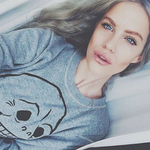 Молода шведська модель розповіла про проблему, яка заважає її кар'єрі (9 фото + відео) – фото 9