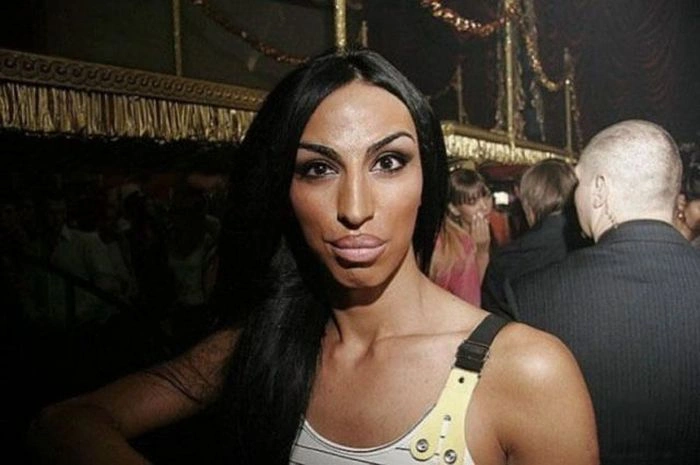 Силіконові принцеси (40 фото) – фото 13