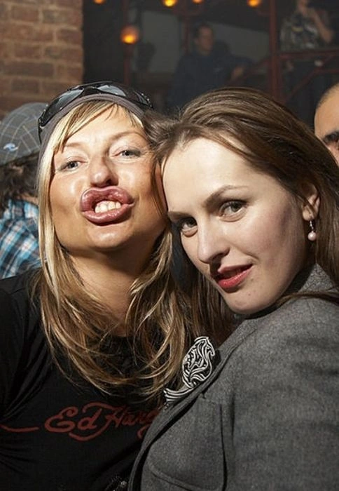 Силіконові принцеси (40 фото) – фото 28