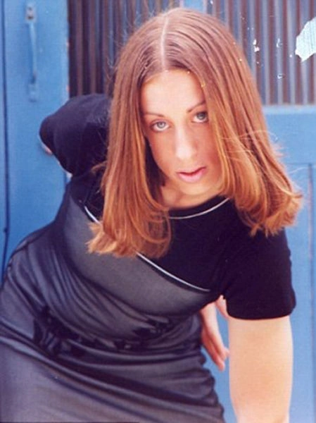 Як змінилась дівчина після пластичних операцій (23 фото) – фото 2