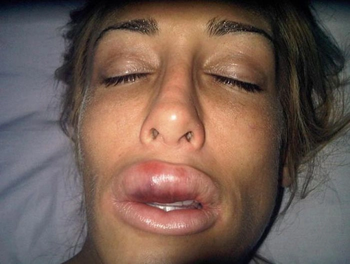 Як змінилась дівчина після пластичних операцій (23 фото) – фото 8