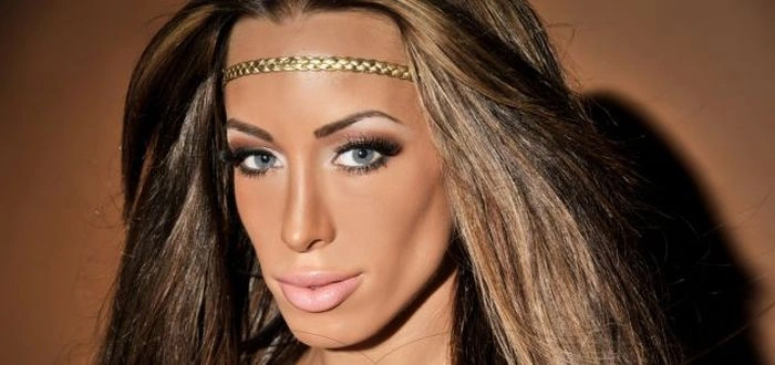 Як змінилась дівчина після пластичних операцій (23 фото) – фото 14