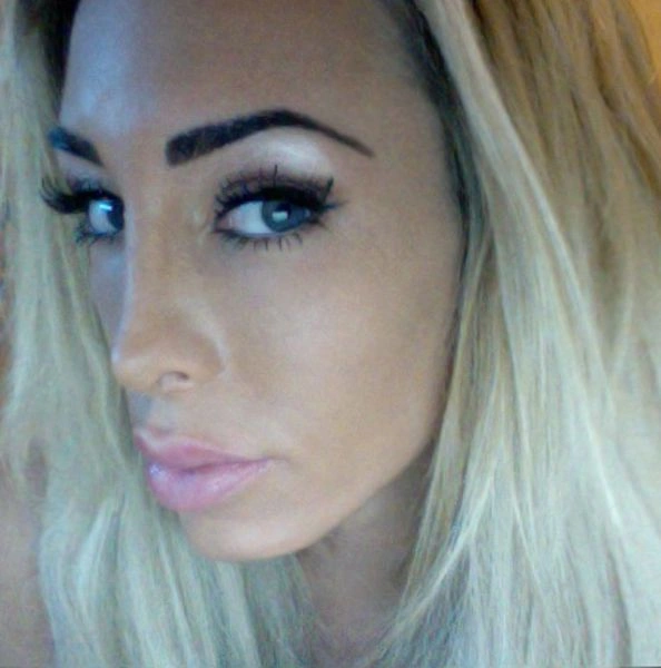 Як змінилась дівчина після пластичних операцій (23 фото) – фото 22