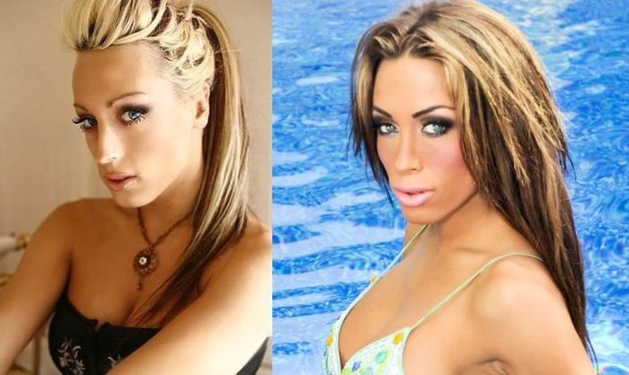 Як змінилась дівчина після пластичних операцій (23 фото) – фото 23