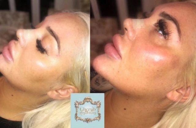 Ембер Мей - скромна дівчина з Англії, яка стала "силіконовою" зіркою (10 фото) – фото 9