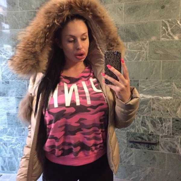 Дівчата, які переборщили з ботоксом і силіконом (25 фото) – фото 2