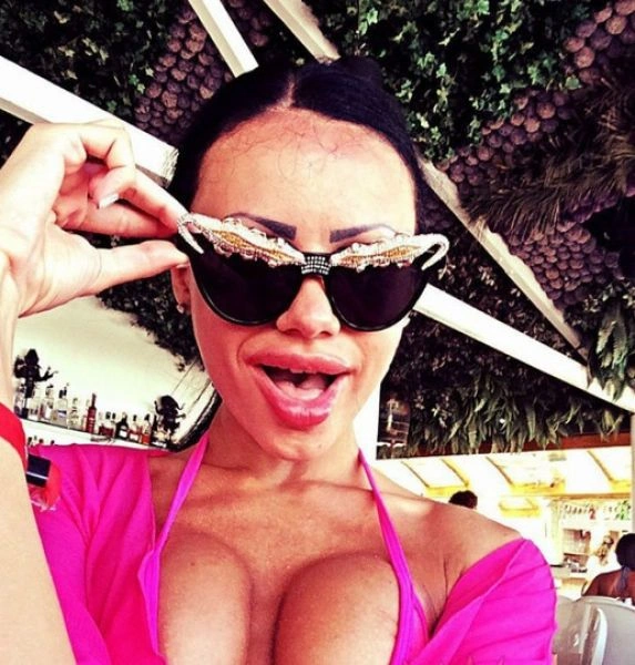 Дівчата, які переборщили з ботоксом і силіконом (25 фото) – фото 3