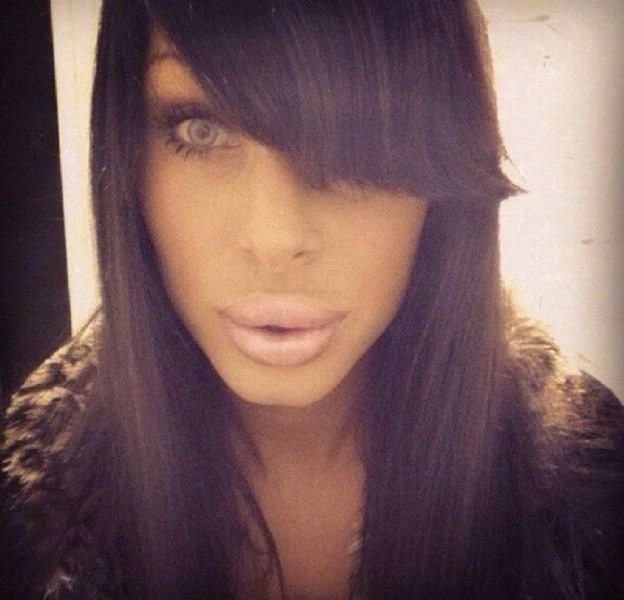 Дівчата, які переборщили з ботоксом і силіконом (25 фото) – фото 4