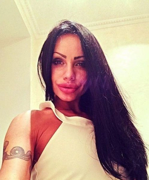 Дівчата, які переборщили з ботоксом і силіконом (25 фото) – фото 5