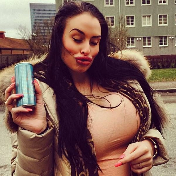 Дівчата, які переборщили з ботоксом і силіконом (25 фото) – фото 7