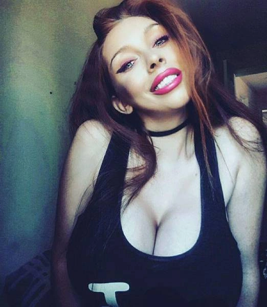 Дівчата, які переборщили з ботоксом і силіконом (25 фото) – фото 12