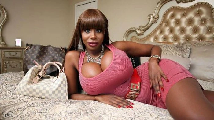 Дівчата, які переборщили з ботоксом і силіконом (25 фото) – фото 14