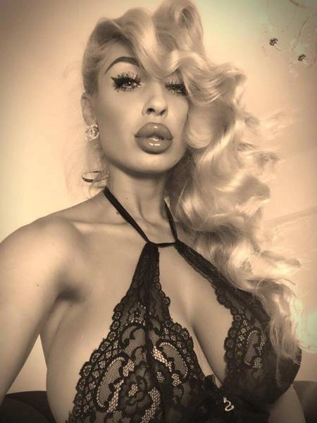 Дівчата, які переборщили з ботоксом і силіконом (25 фото) – фото 18