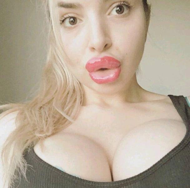 Дівчата, які переборщили з ботоксом і силіконом (25 фото) – фото 22