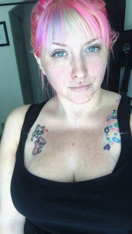 Жінці довелося зменшити розмір грудей (5 фото) – фото 3